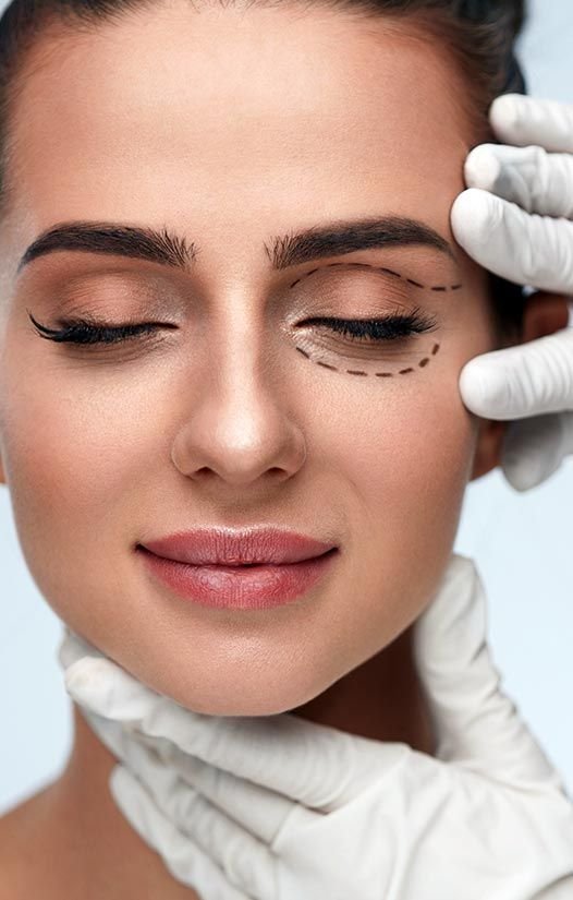 Blepharoplasty